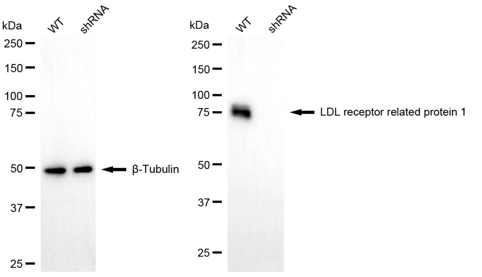 LRP-1 Antibody (24GB4945)