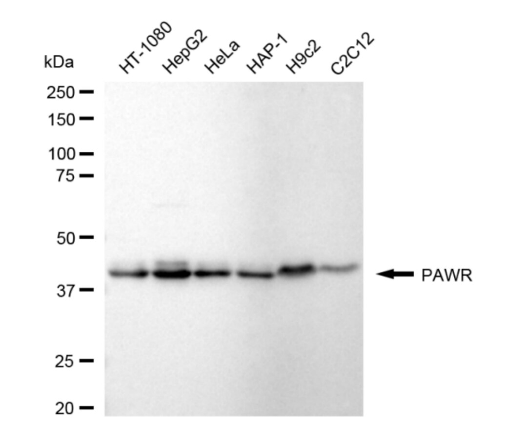 PAWR / PAR4 Antibody (24GB5010)