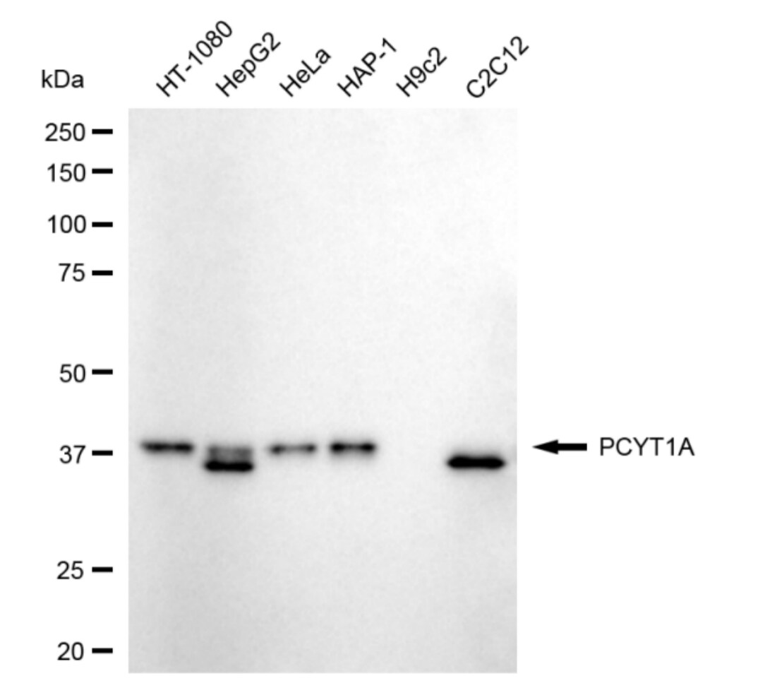 PCYT1A Antibody (24GB5015)