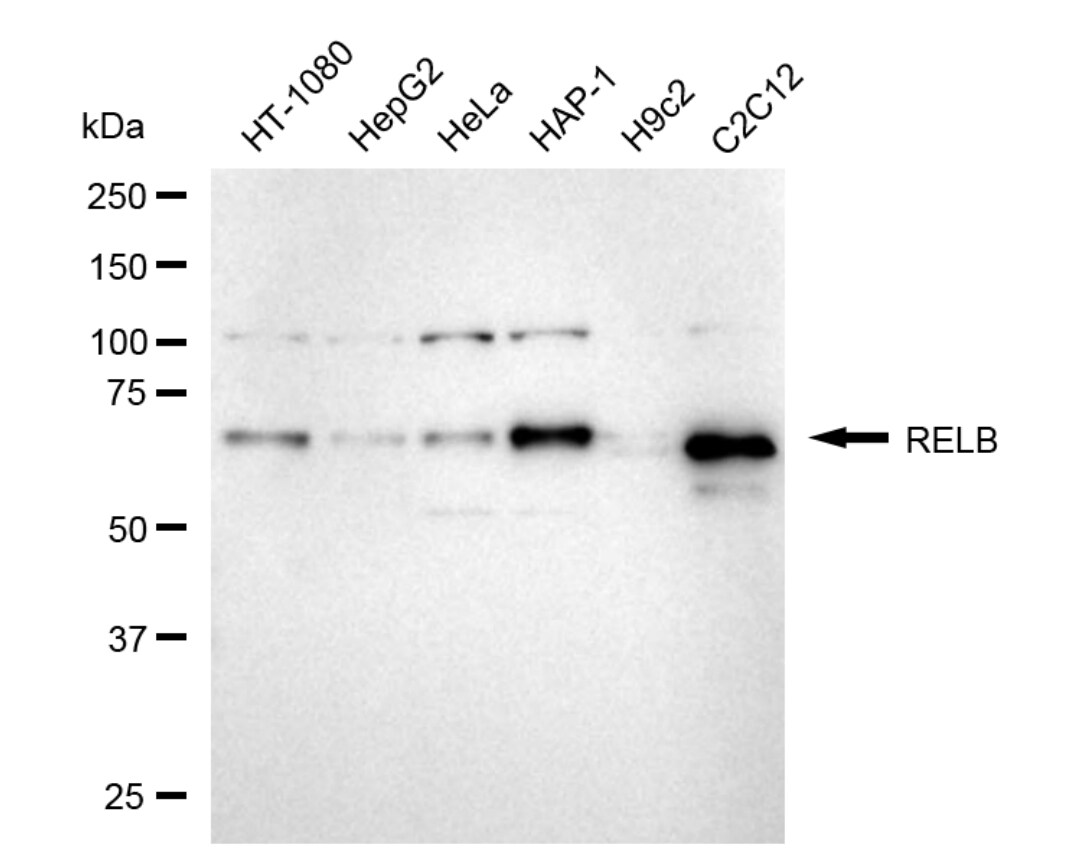 RelB Antibody (24GB5070)