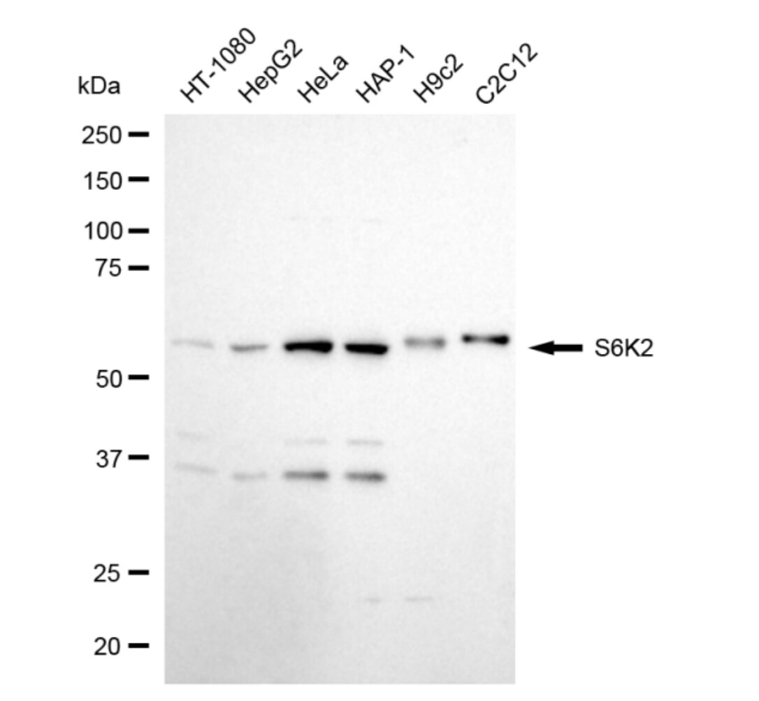 p70 S6 Kinase beta/S6K2 Antibody (24GB5075)