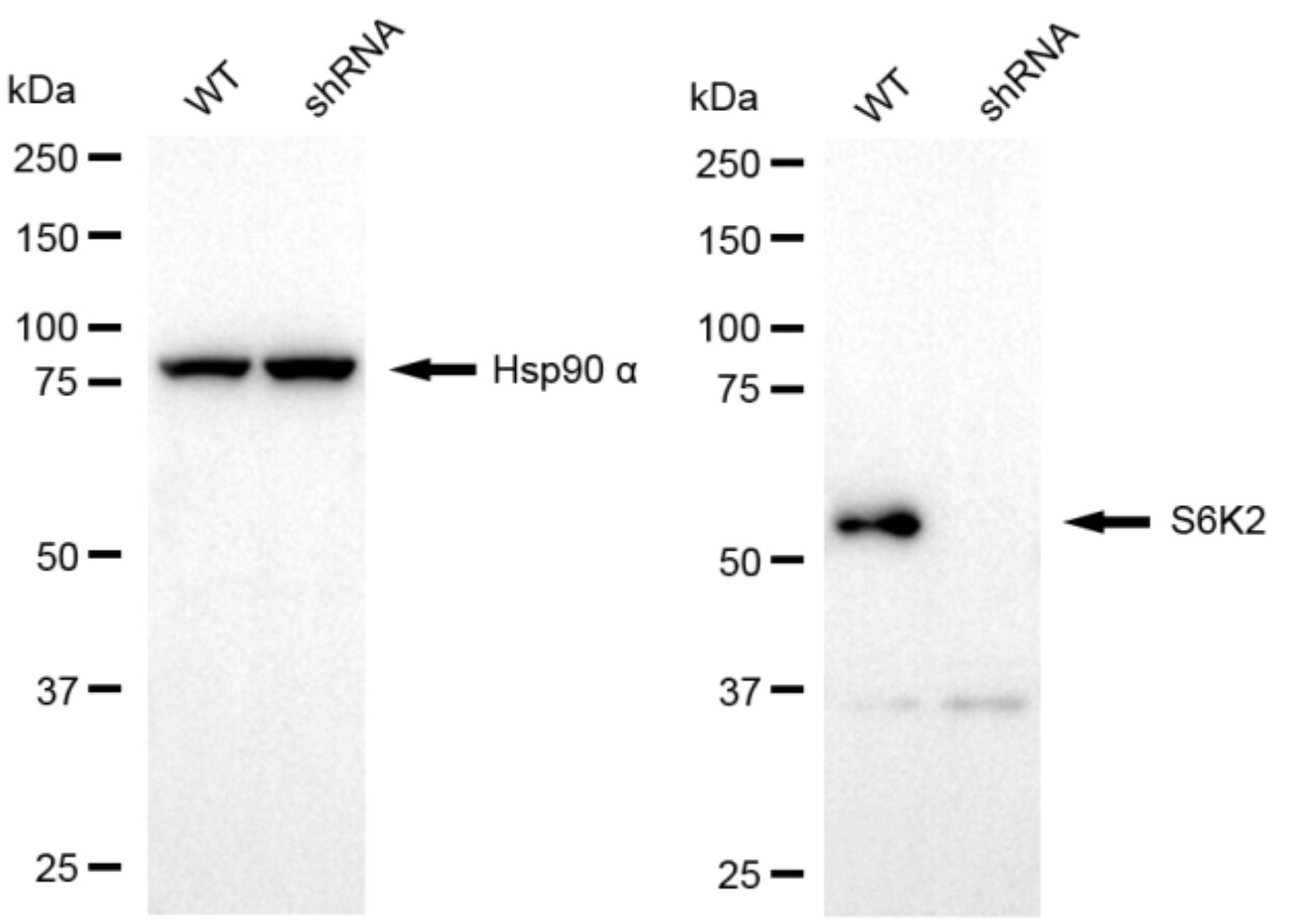 p70 S6 Kinase beta/S6K2 Antibody (24GB5075)