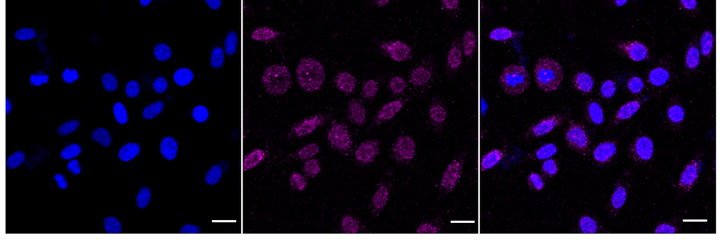 Alkaline Phosphatase/ALPP Antibody (24GB5430)