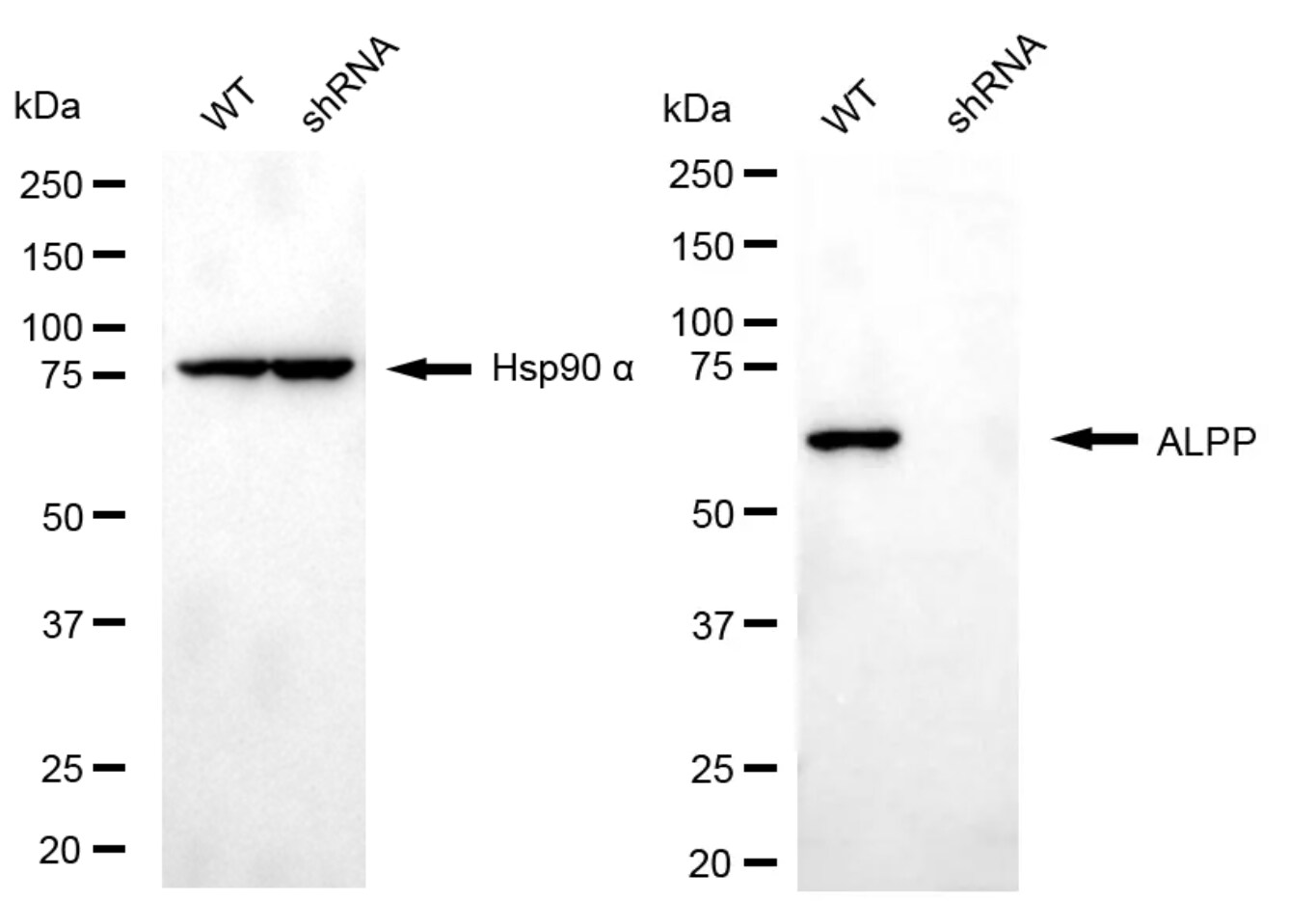 Alkaline Phosphatase/ALPP Antibody (24GB5430)
