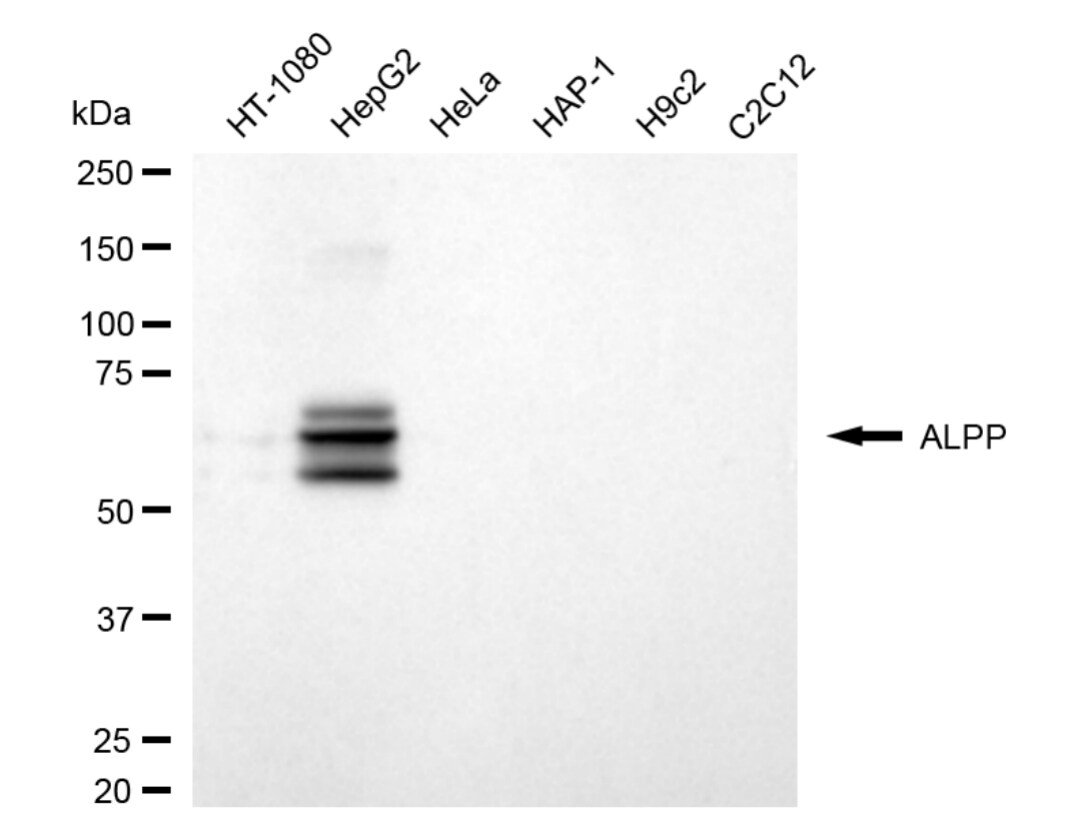 Alkaline Phosphatase/ALPP Antibody (24GB5430)