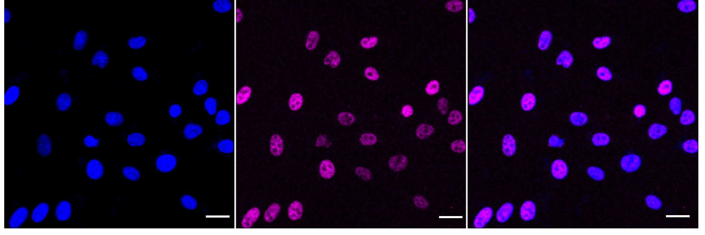 HSF1 [p Ser307] Antibody (24GB5445)