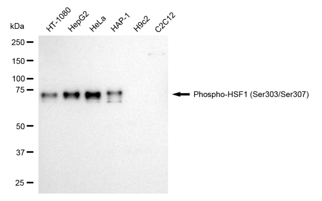 HSF1 [p Ser307] Antibody (24GB5445)