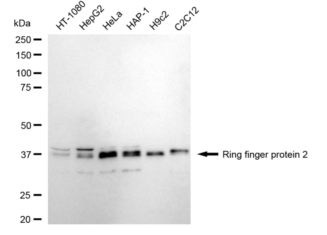 RNF2 Antibody (24GB5455)
