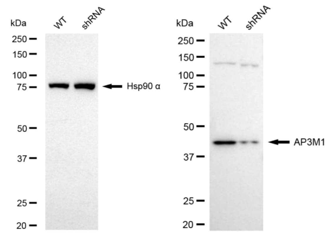AP3M1 Antibody (24GB6160)