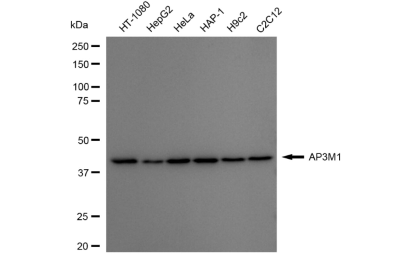AP3M1 Antibody (24GB6160)