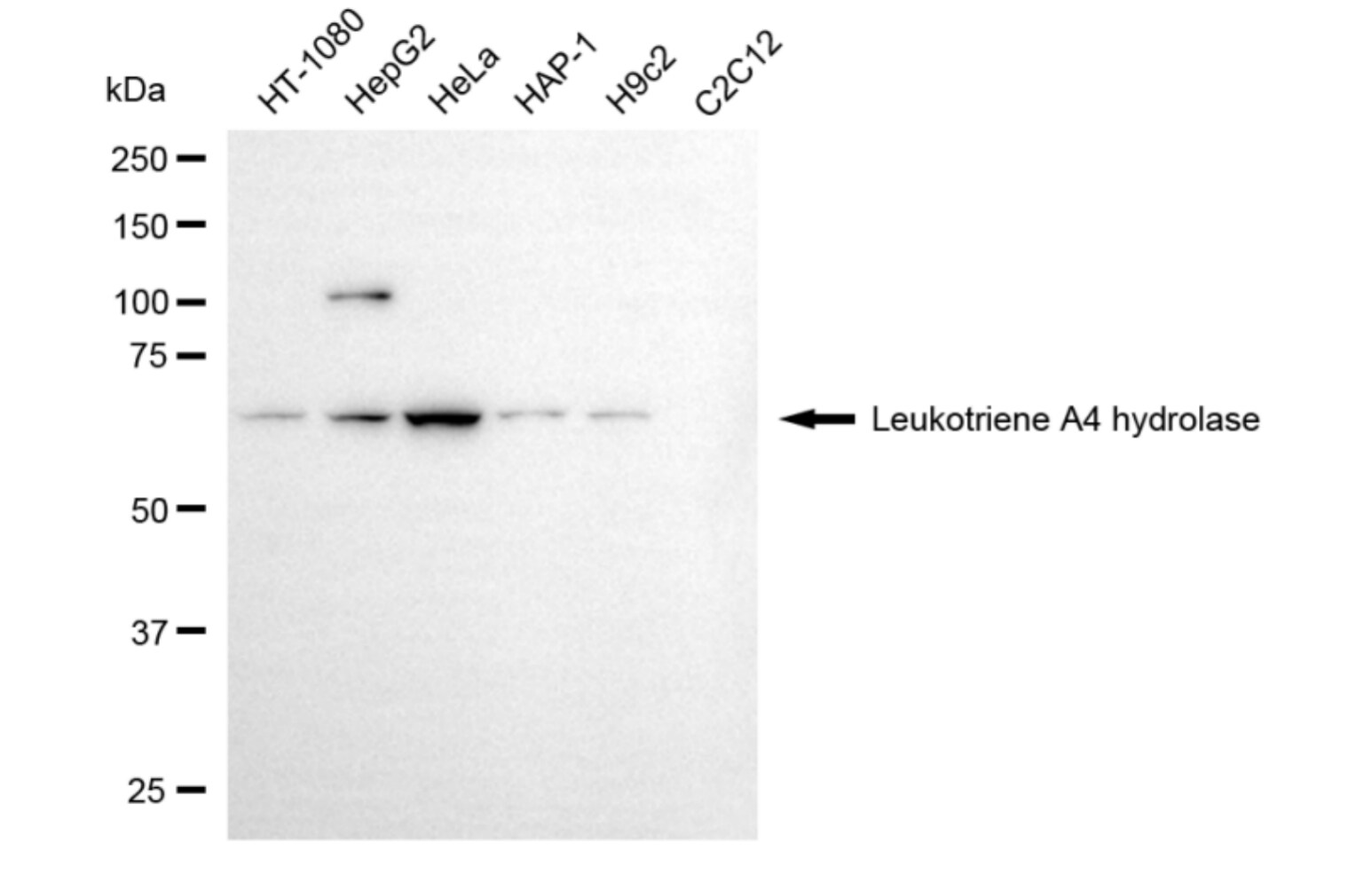 Leukotriene A4 Hydrolase/LTA4H Antibody (24GB5535)