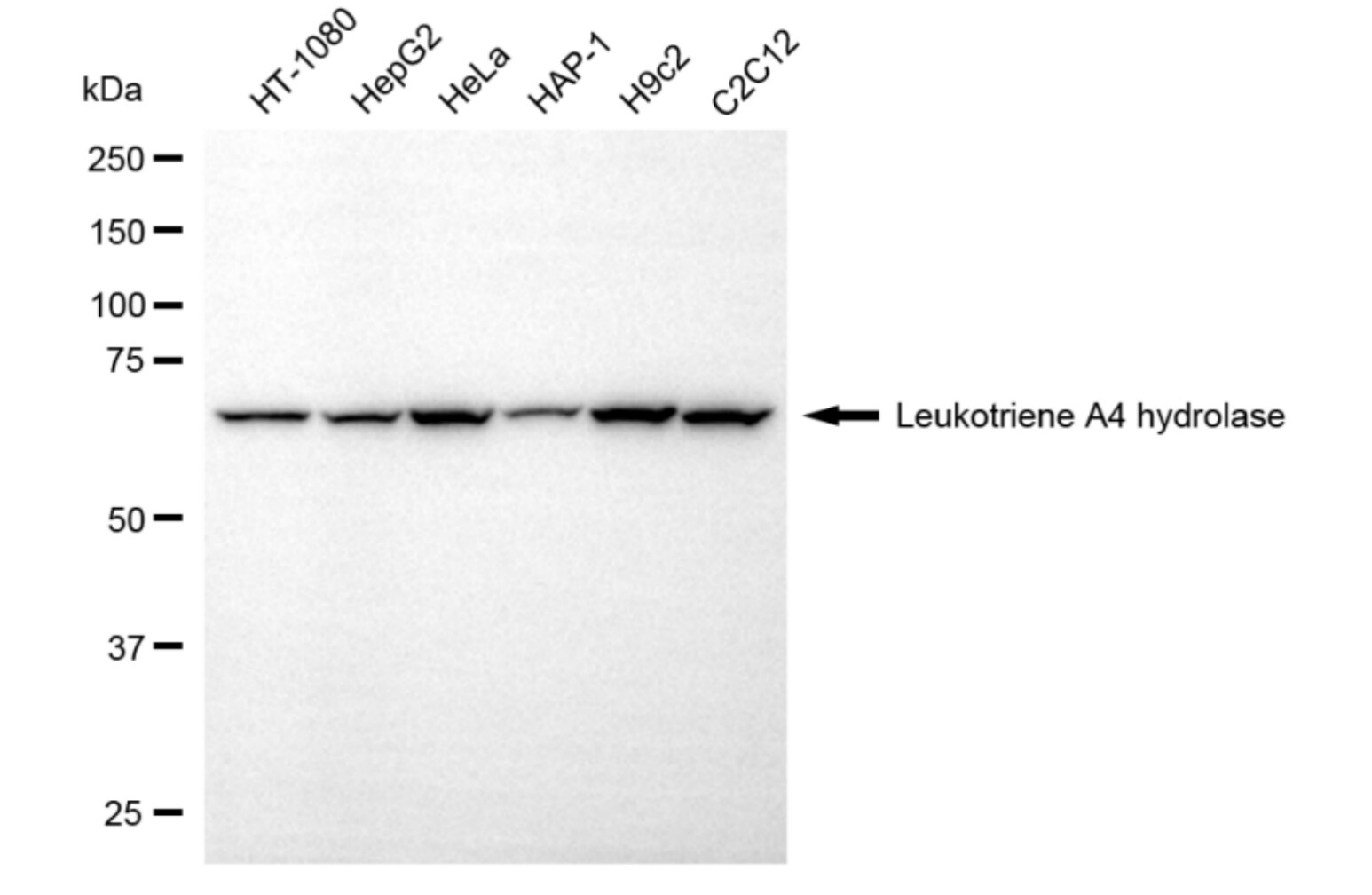 Leukotriene A4 Hydrolase/LTA4H Antibody (24GB5540)