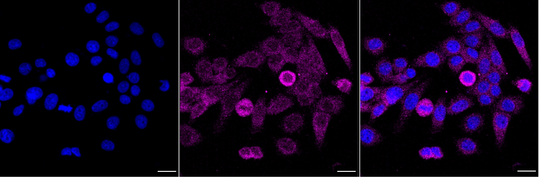 Destrin Antibody (24GB5630)