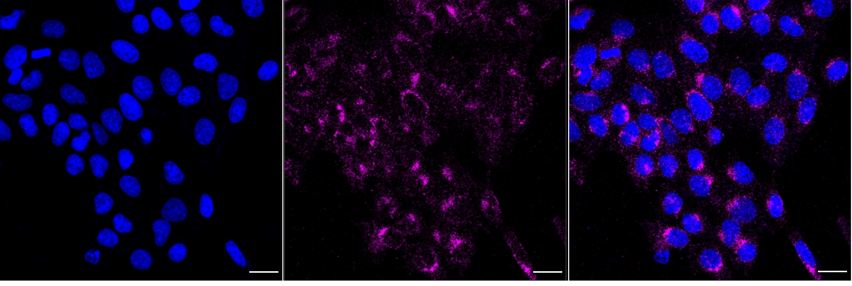 ErbB2/Her2 Antibody (24GB5710)