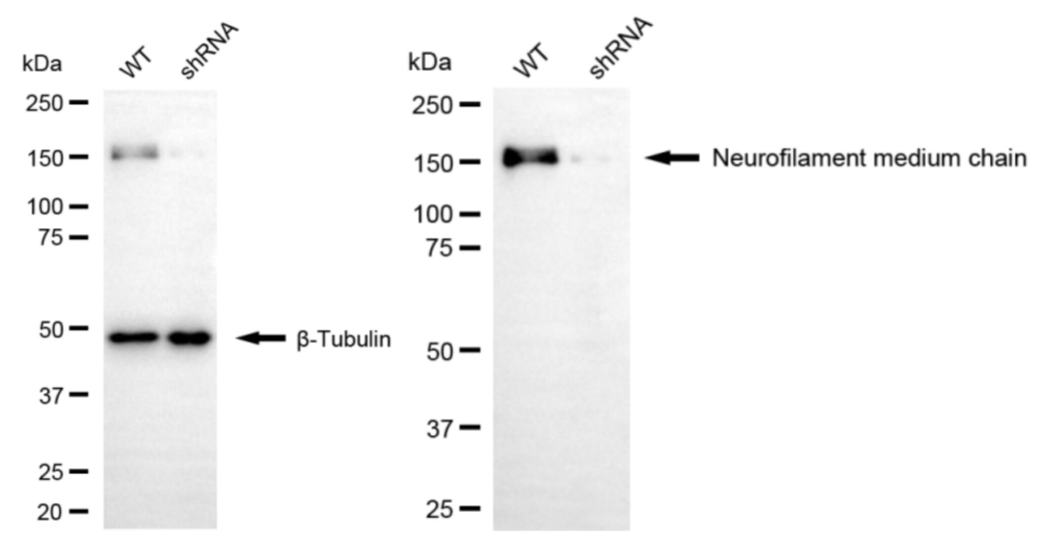 NF-M Antibody (24GB5825)