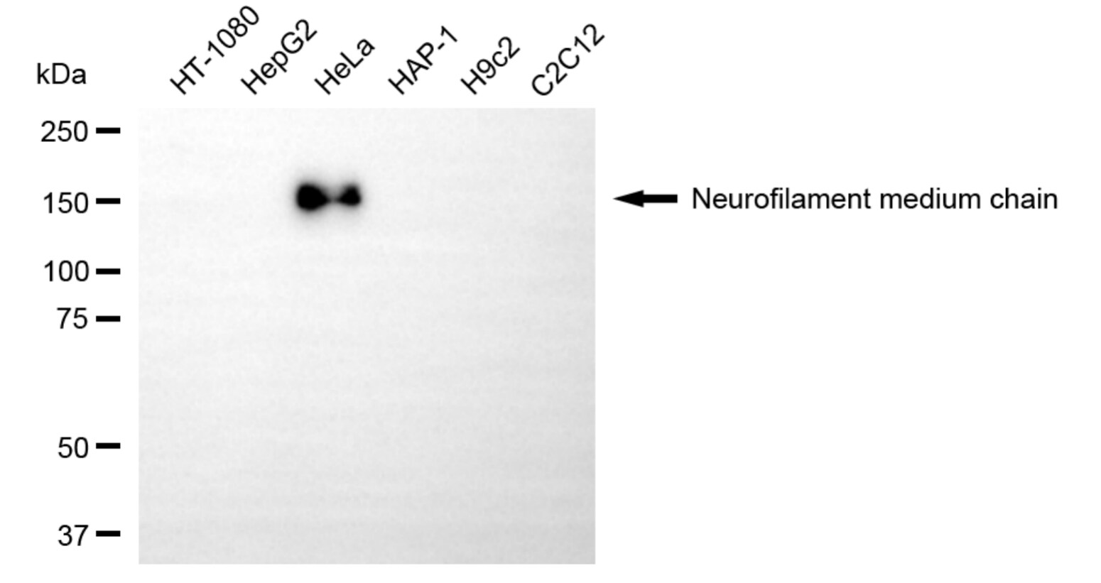 NF-M Antibody (24GB5825)