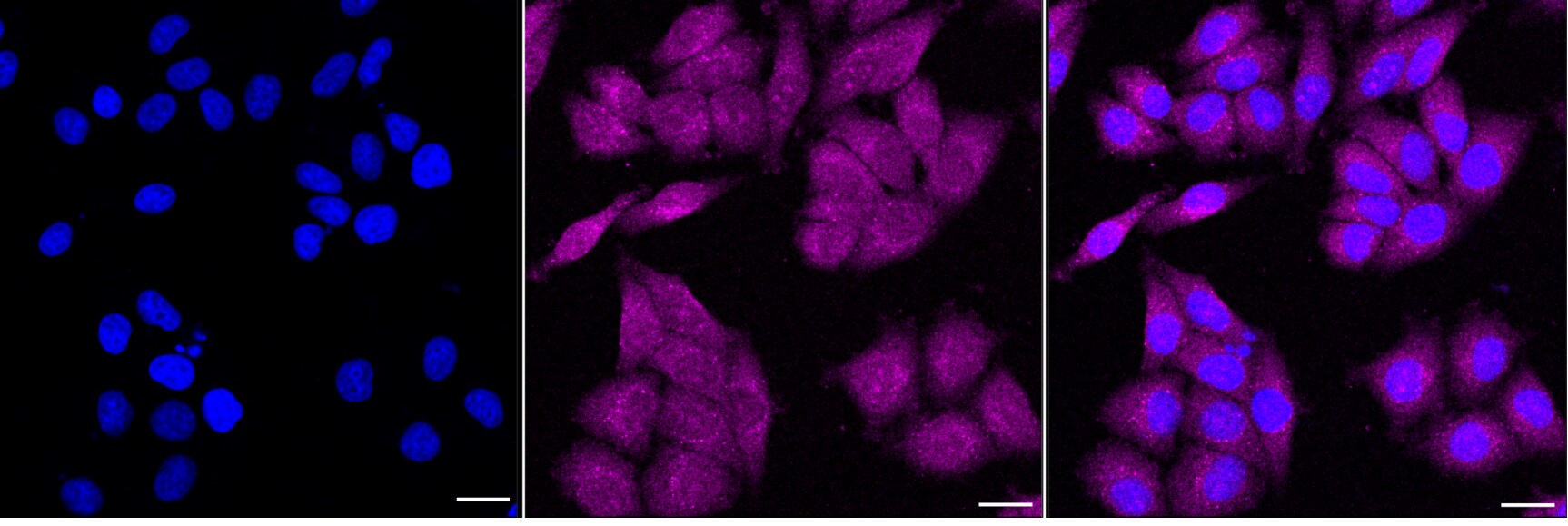 AKR1A1 Antibody (24GB6220)