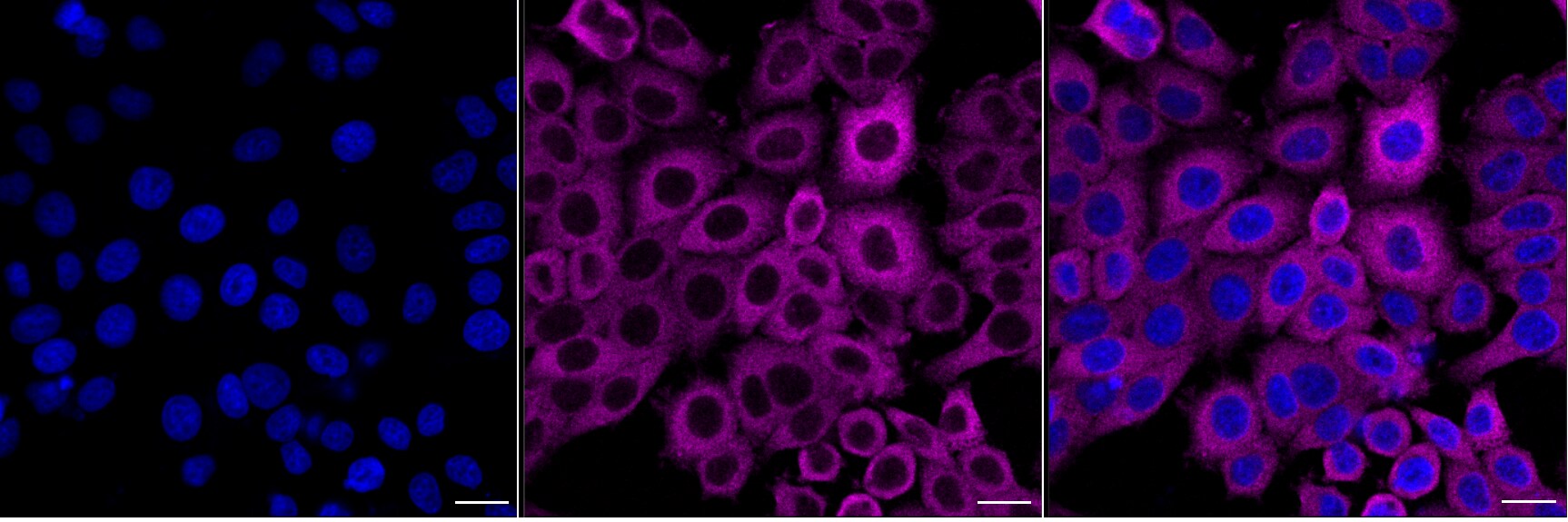 PFKP Antibody (24GB6380)