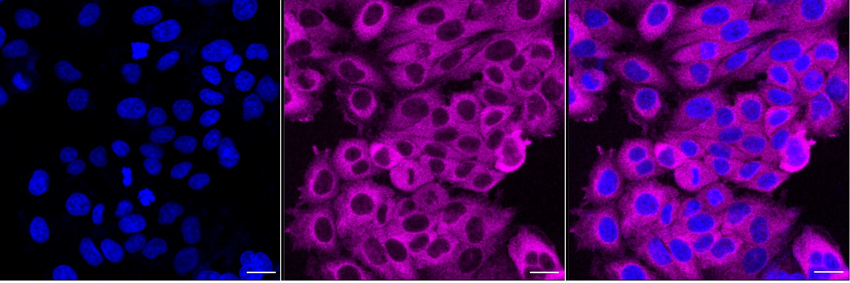 PFKP Antibody (24GB6405)