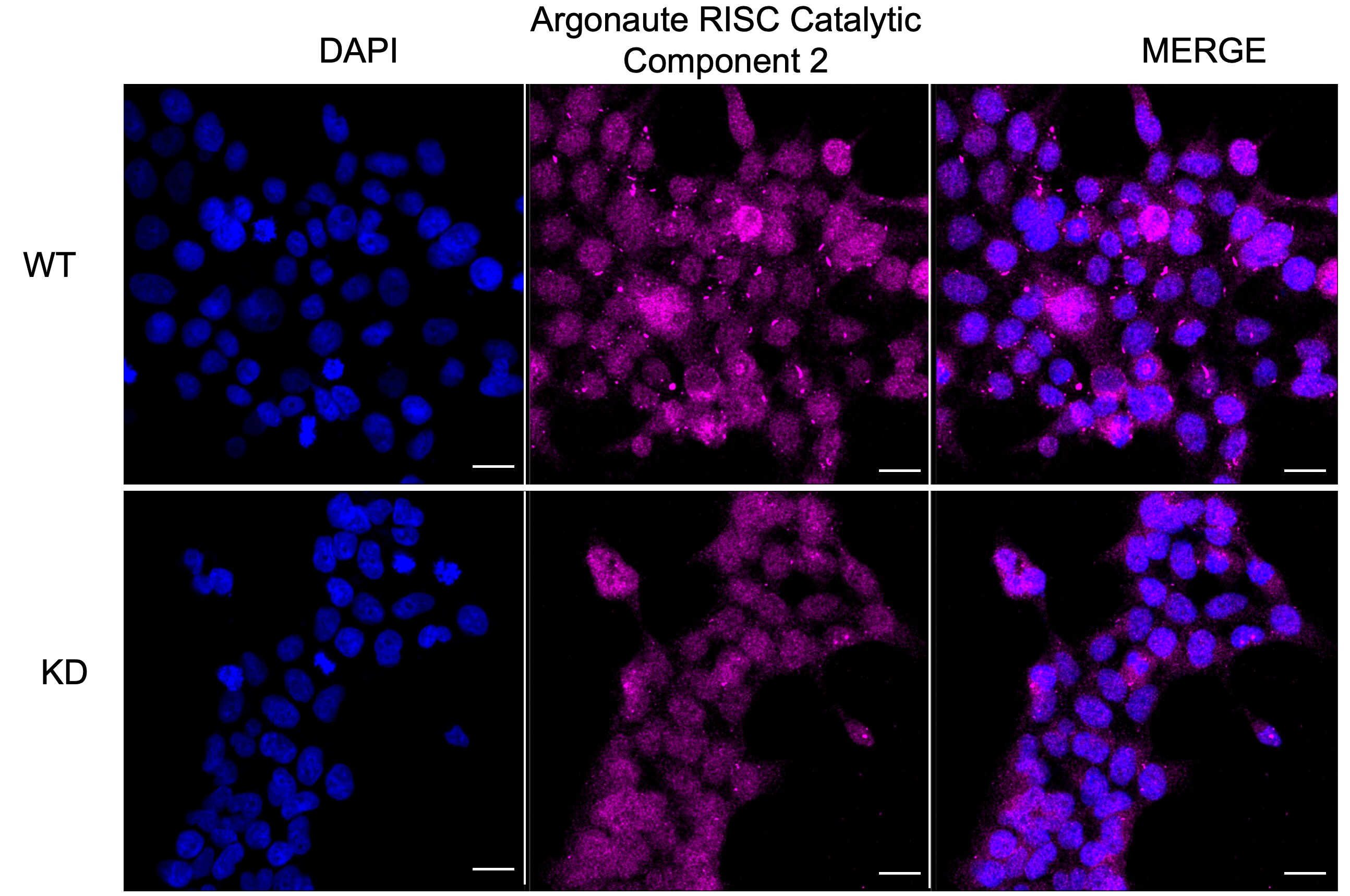 Ago2/eIF2C2 Antibody (23GB1790)