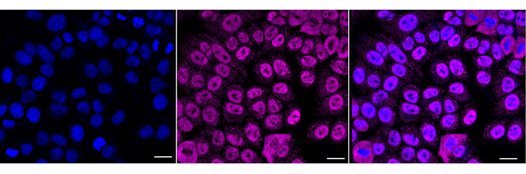hnRNP F Antibody (24GB6670)