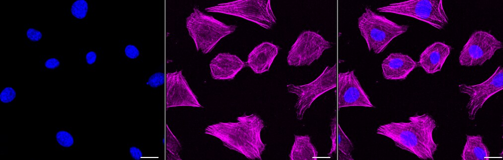 alpha-Smooth Muscle Actin Antibody (23GB600)