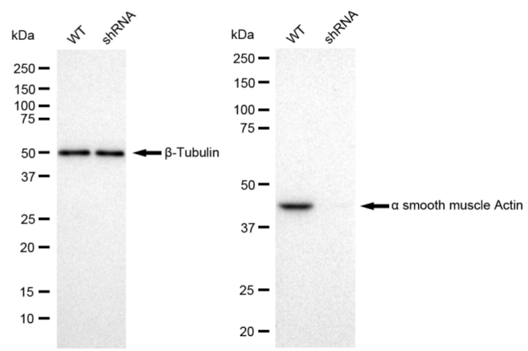 alpha-Smooth Muscle Actin Antibody (23GB600)