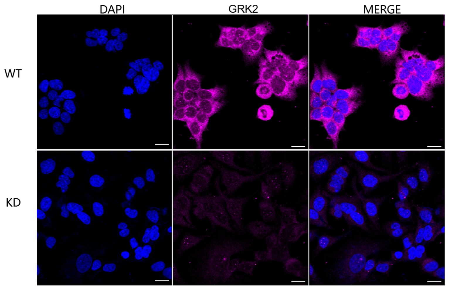 GRK2 Antibody (23GB1515)