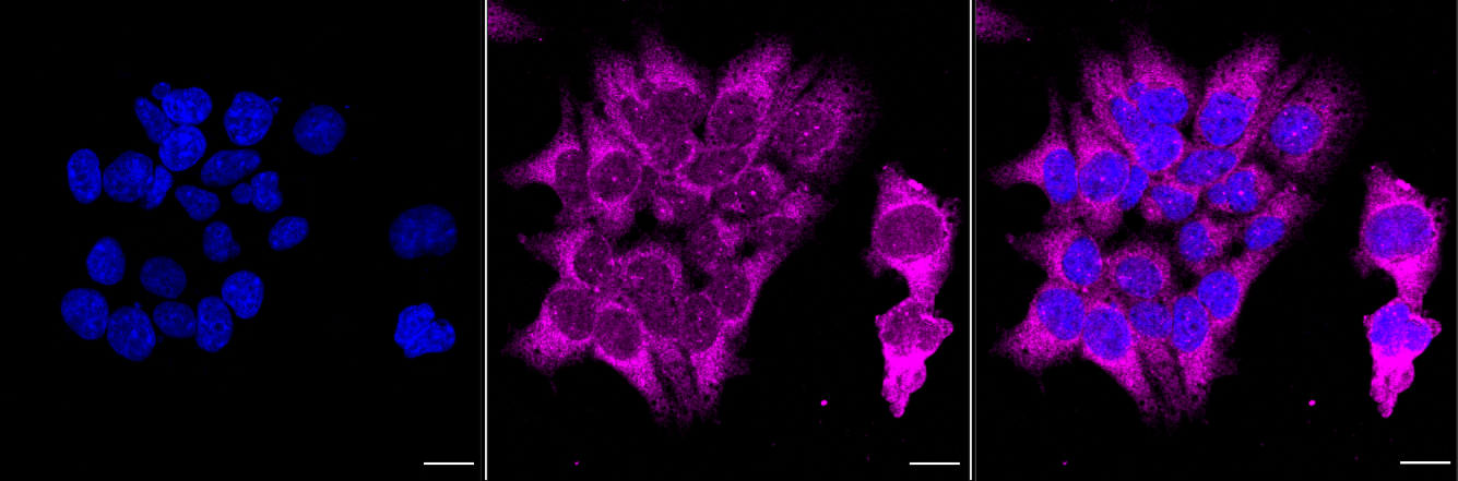 GRK2 Antibody (23GB1515)