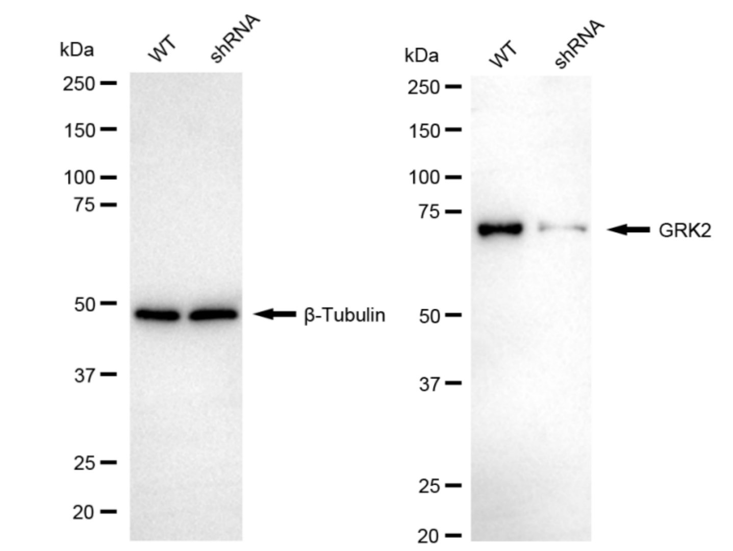 GRK2 Antibody (23GB1515)