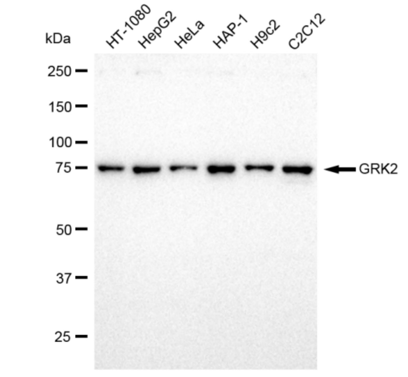 GRK2 Antibody (23GB1515)