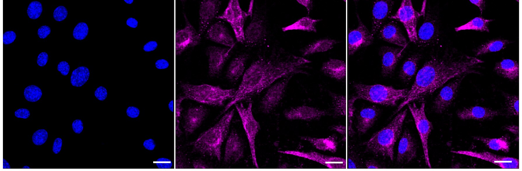 PRAS40 Antibody (23GB640)