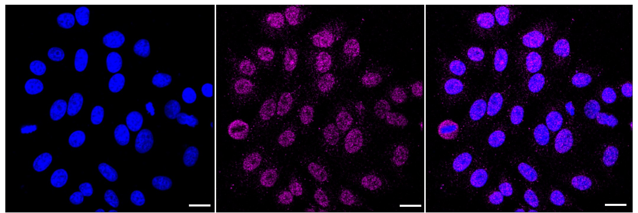 Glucose 6 Phosphate Dehydrogenase Antibody (23GB1795)