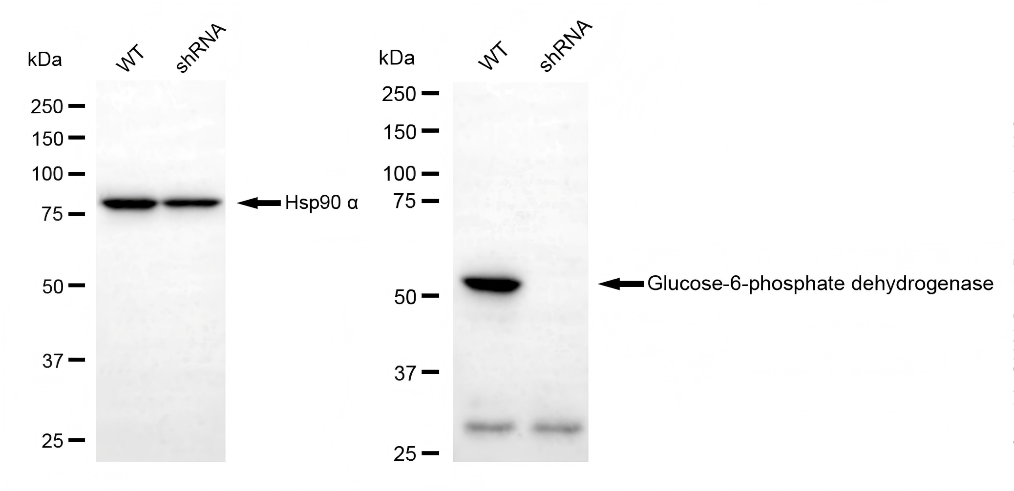 Glucose 6 Phosphate Dehydrogenase Antibody (23GB1795)
