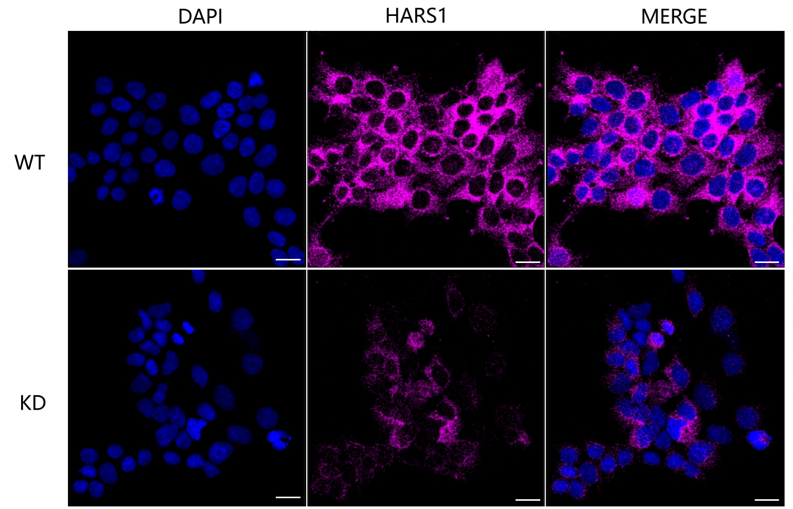 HARS Antibody (24GB6755)