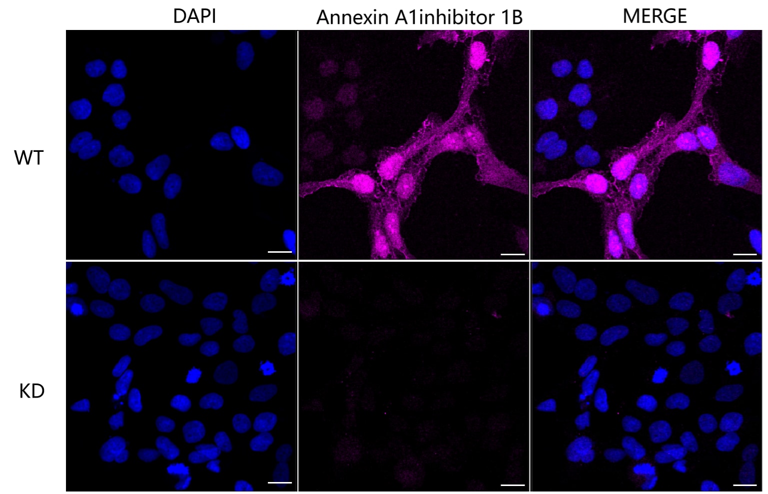 Annexin A1 Antibody (24GB6815)