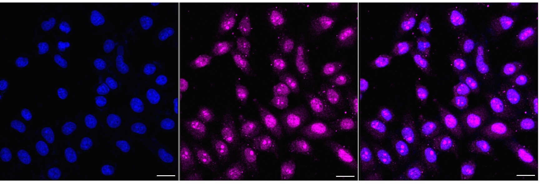 ATP6V1A Antibody (24GB6940)