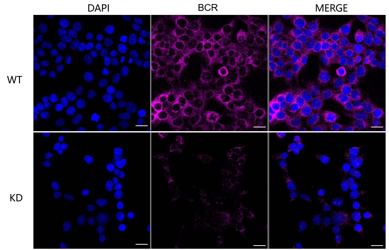 BCR Antibody (24GB6945)
