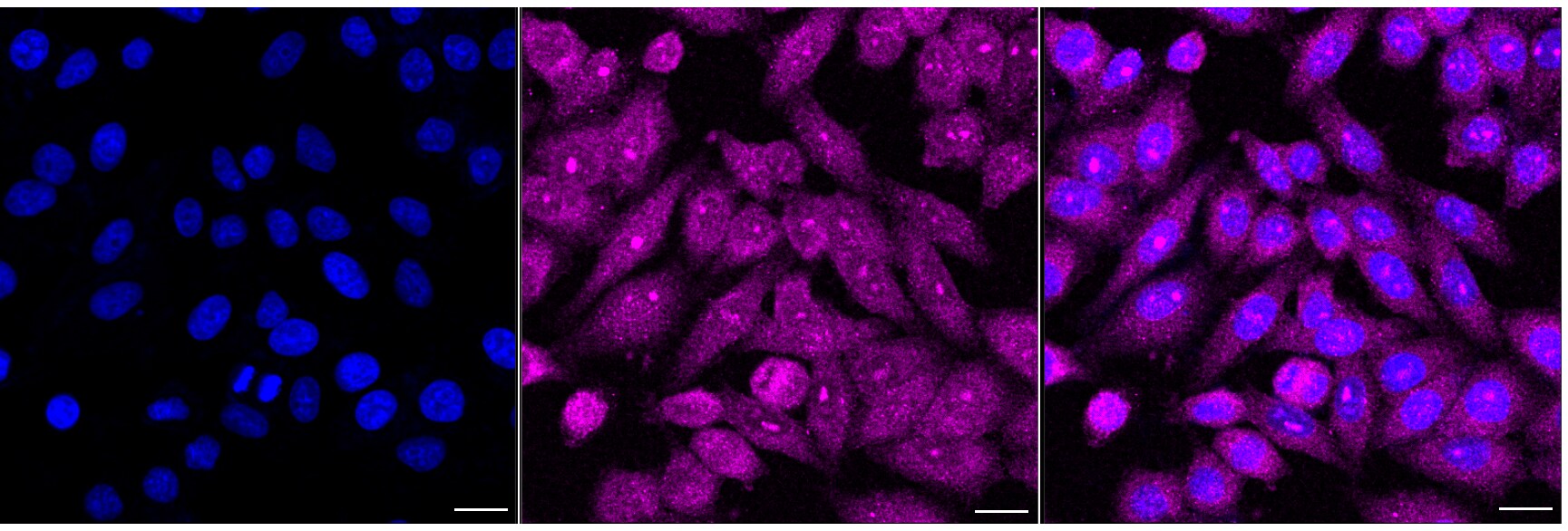 BCR Antibody (24GB6945)