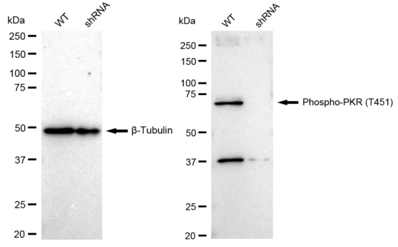 PKR [p Thr451] Antibody (23GB1710)