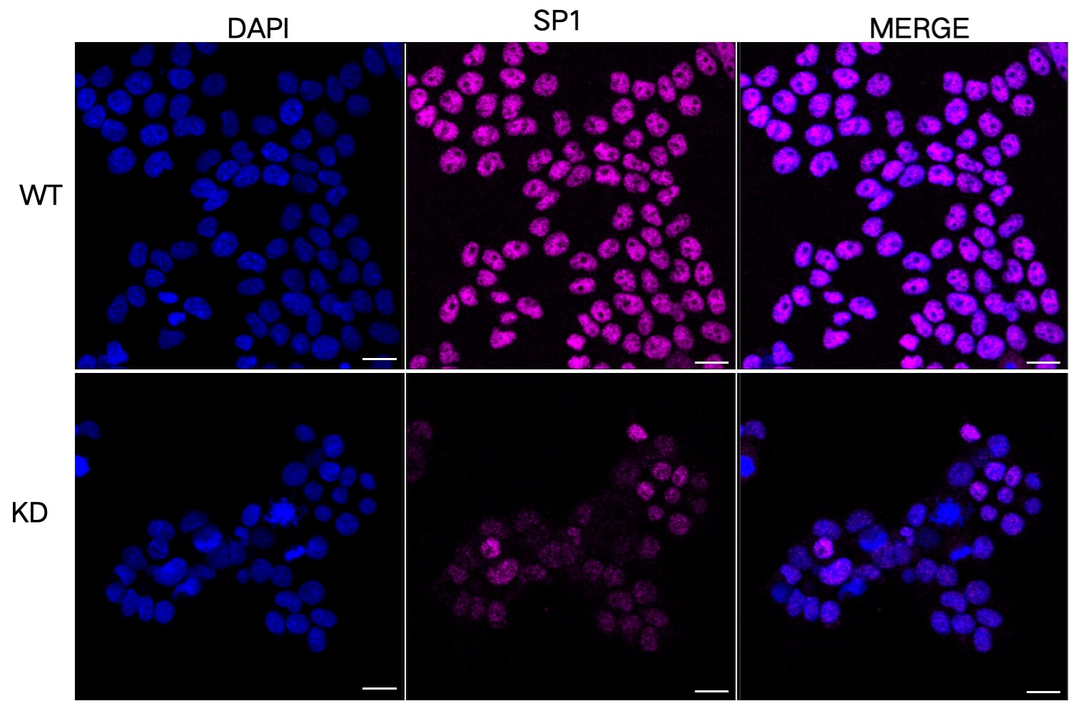 SP1 Antibody (24GB7095)