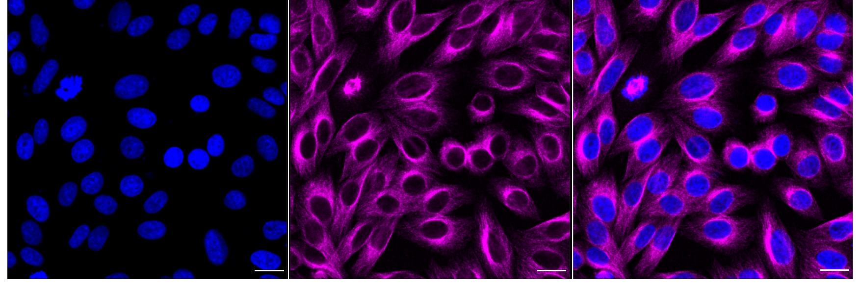 VEGFR1/Flt-1 Antibody (24GB7115)