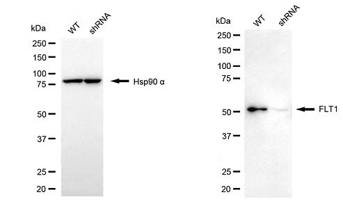 VEGFR1/Flt-1 Antibody (24GB7115) Knockdown Validated: VEGFR1/Flt-1 Antibody (24GB7115) [NBP3-51816]
