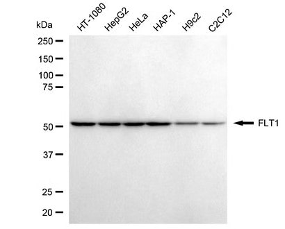 VEGFR1/Flt-1 Antibody (24GB7115) Western blot: VEGFR1/Flt-1 Antibody (24GB7115) [NBP3-51816]