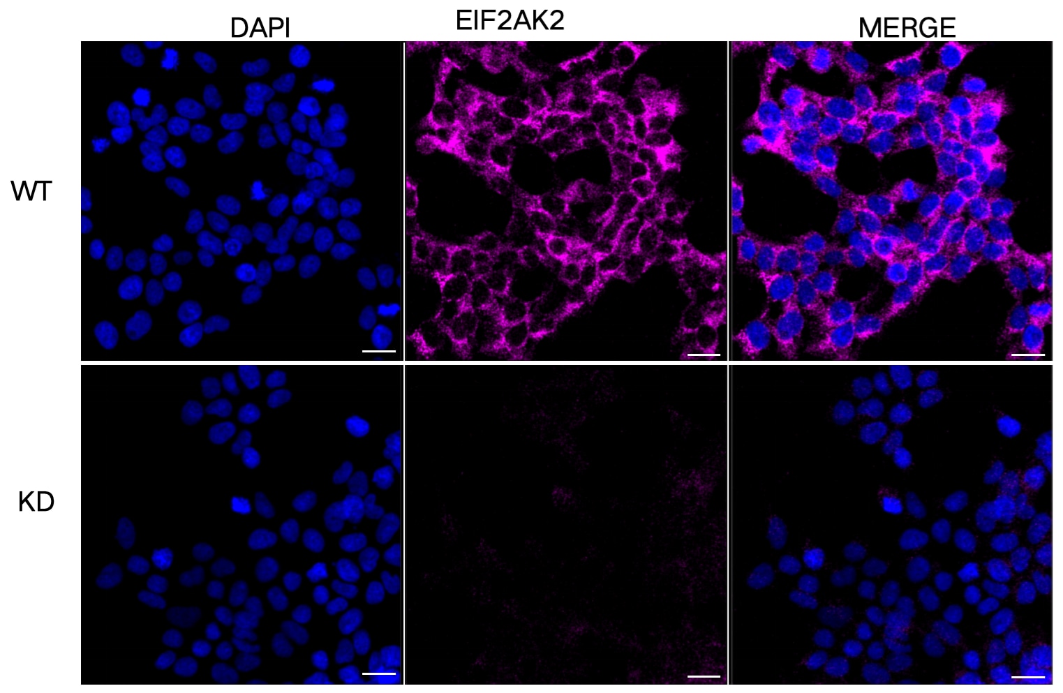 PKR Antibody (24GB7125)