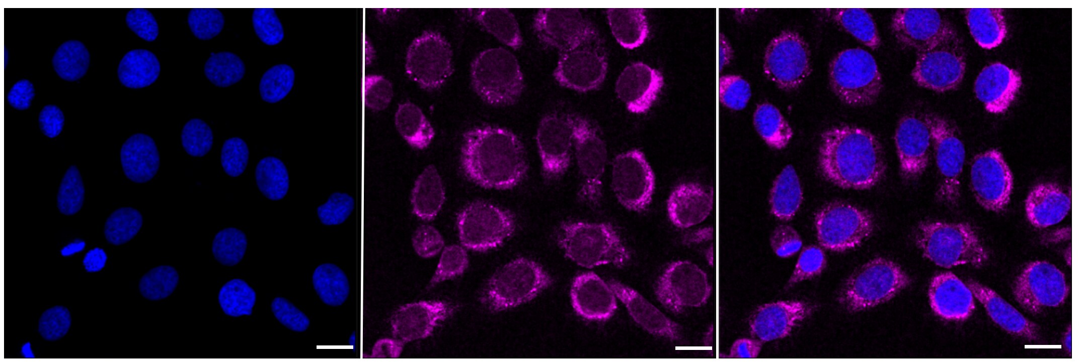 PCAF Antibody (23GB910)