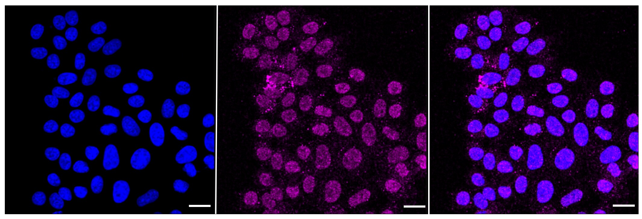 ErbB2/Her2 Antibody (23GB1350)