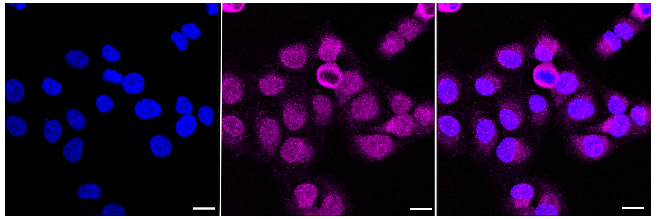 Integrin beta 1/CD29 Antibody (23GB895)
