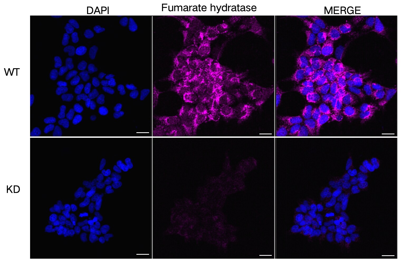 Fumarase Antibody (24GB13010)
