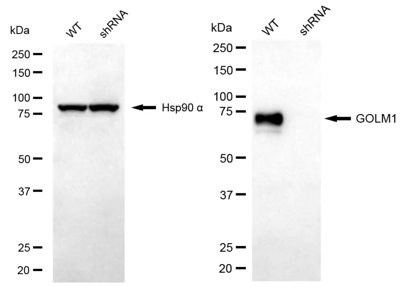 GOLM1 Antibody (24GB13075)